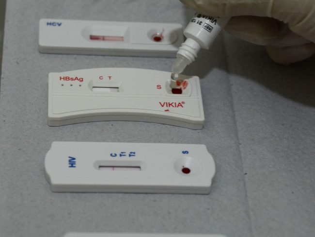 teste rápido de HIV e hepatites B e C