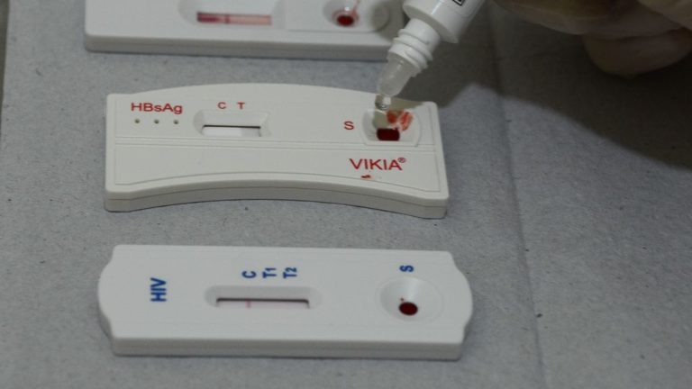 teste rápido de HIV e hepatites B e C