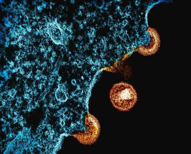 national-institute-of-allergy-and-infectious-diseases-Jr3FJg1krfk-unsplash