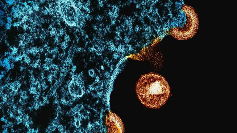 national-institute-of-allergy-and-infectious-diseases-Jr3FJg1krfk-unsplash