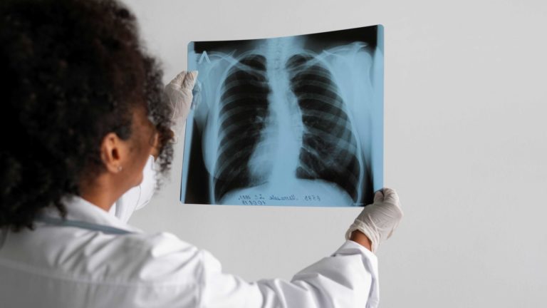 side-view-doctor-looking-radiography