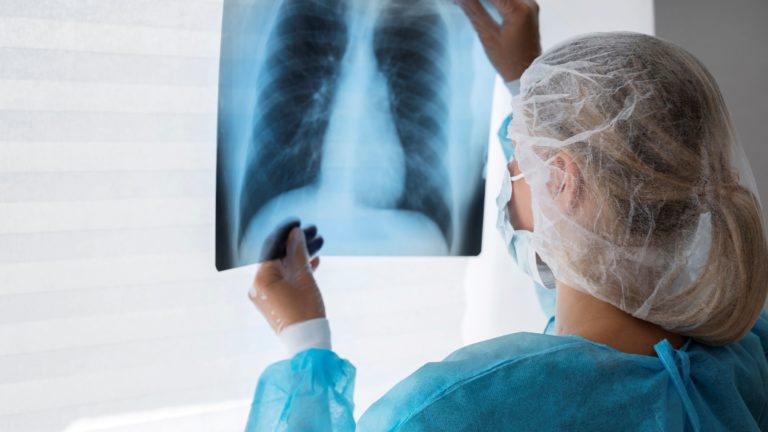 side-view-doctor-checking-radiography1
