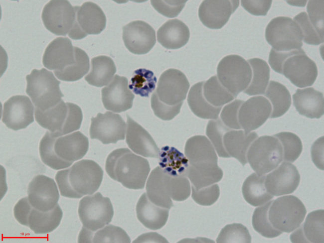 Esquizontes de Plasmodium vivax, fase de multiplicação do parasita, no interior de glóbulos vermelhos observados ao microscópio.
