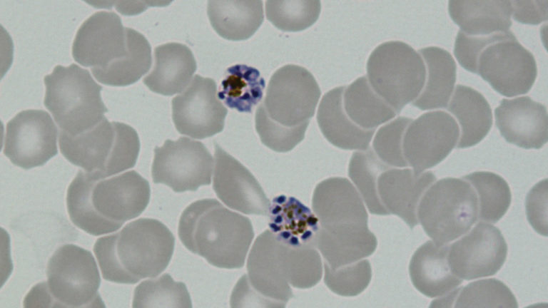 Esquizontes de Plasmodium vivax, fase de multiplicação do parasita, no interior de glóbulos vermelhos observados ao microscópio.